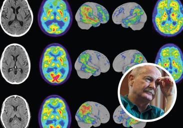 Rafael Yuste: «Podemos cambiar la actividad cerebral, ya no es ciencia ficción»