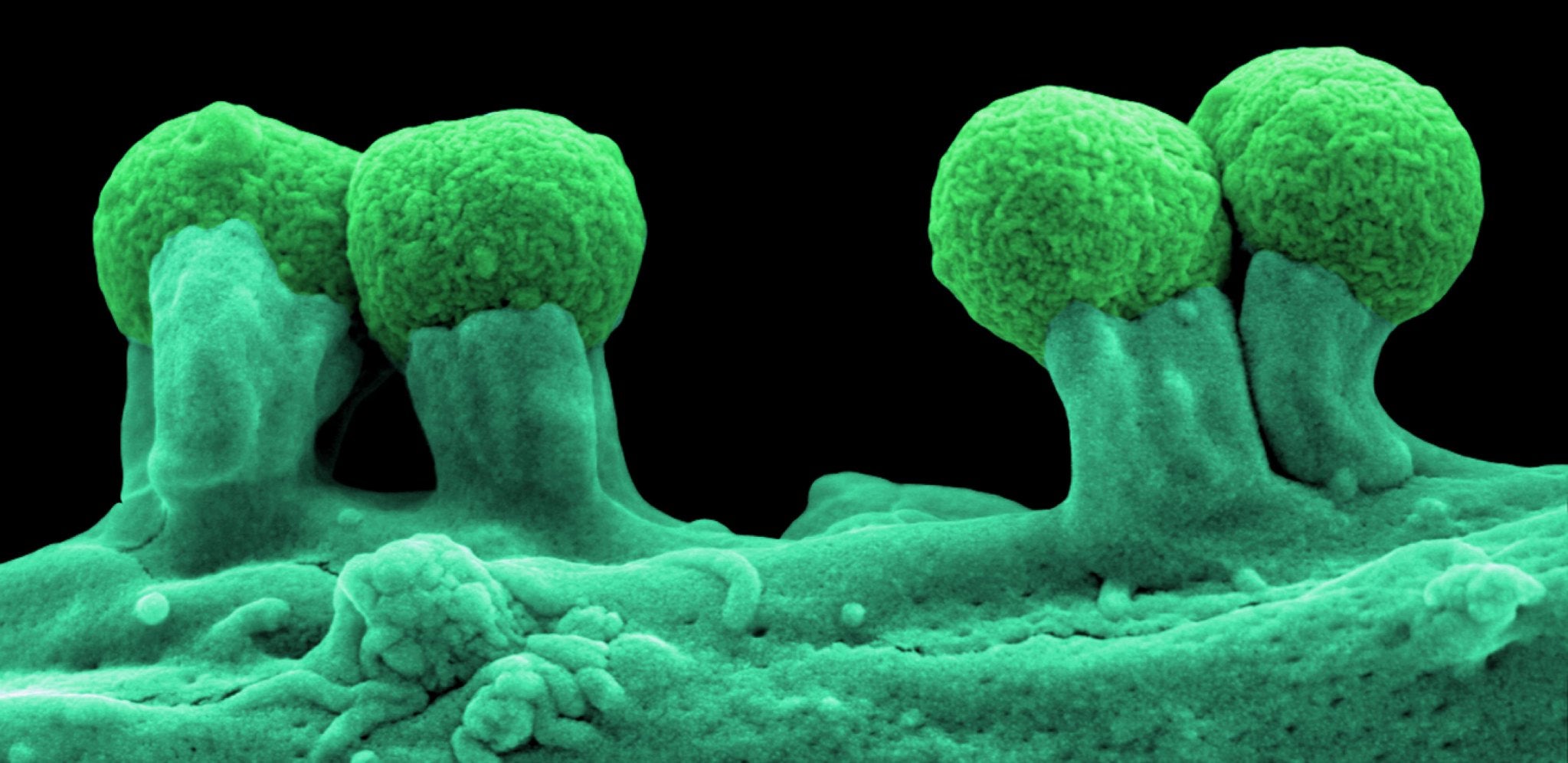 E. coli en cultivo celular de fibroblastos